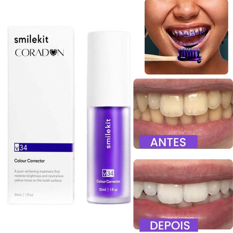 Clareador Dental Smile - Dentes Brancos Em Segundos